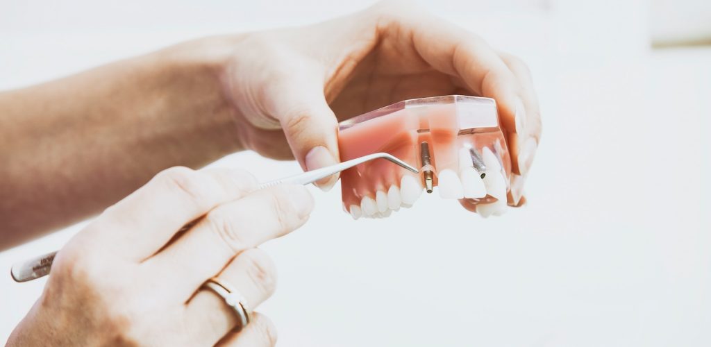 person wearing silver-colored ring while holding denture